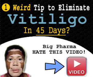 Vitiligo Miracle: Cure vitiligo in 30 days at home